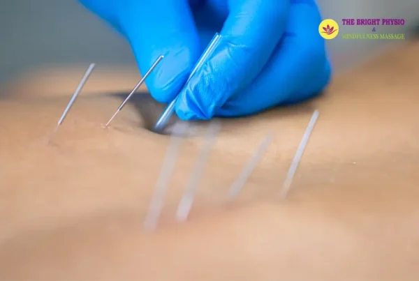 Physiotherapist performing dry needling | Thebrightphysio